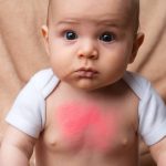 comment gérer les reflux gastriques chez les nourrissons